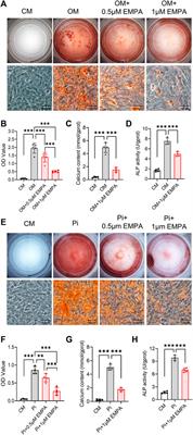 Empagliflozin alleviates atherosclerotic calcification by inhibiting osteogenic differentiation of vascular smooth muscle cells